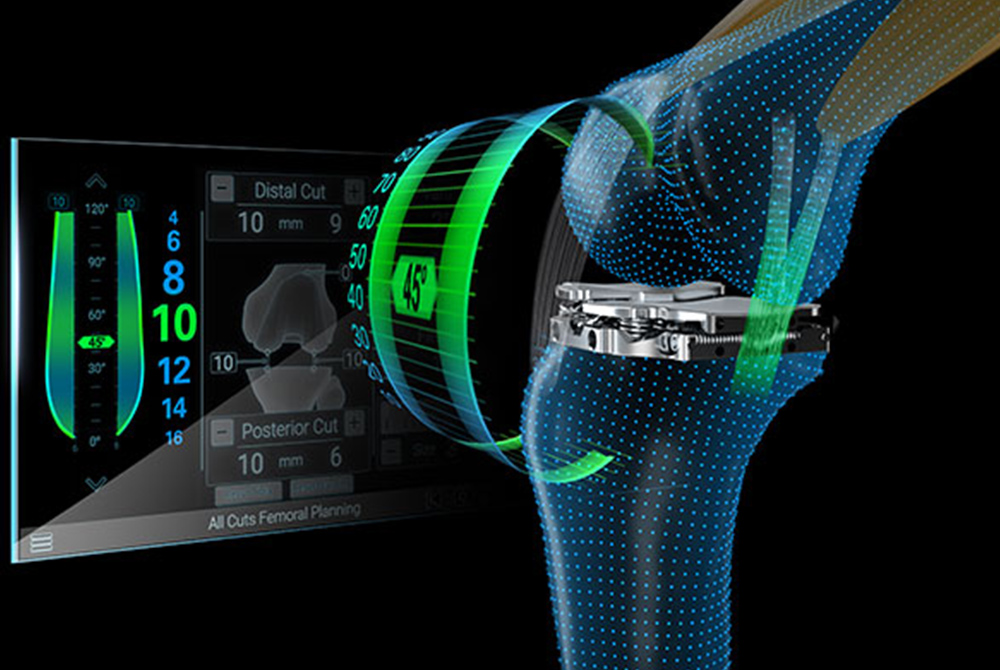 Newton™ Balanced-Knee-System